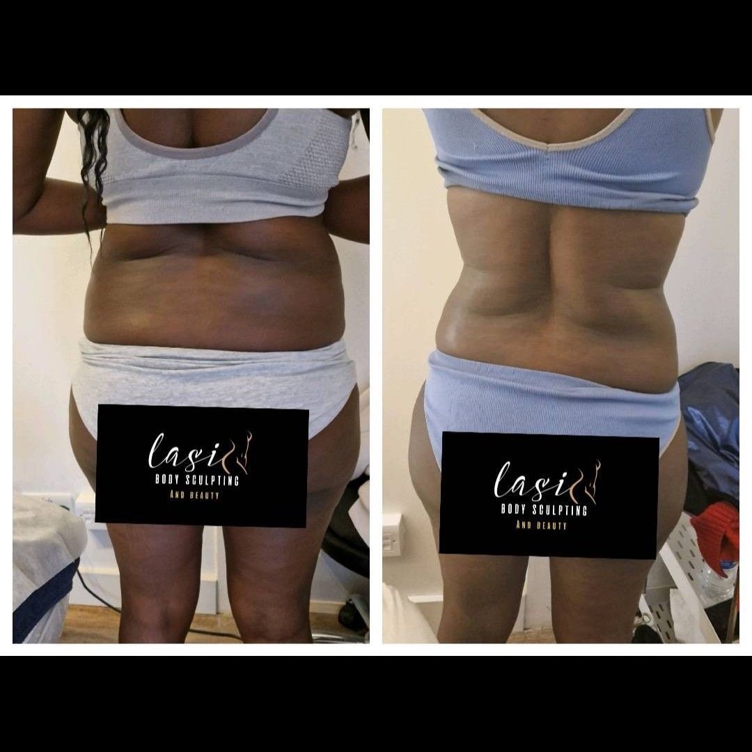 before and after mummy makeover bundle